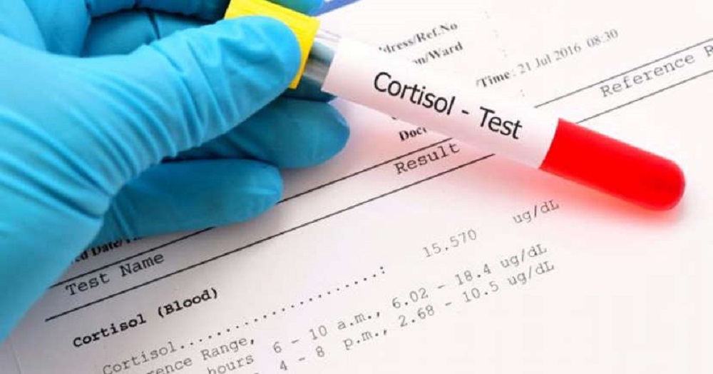 What a cortisol blood stress test reveals about your health.